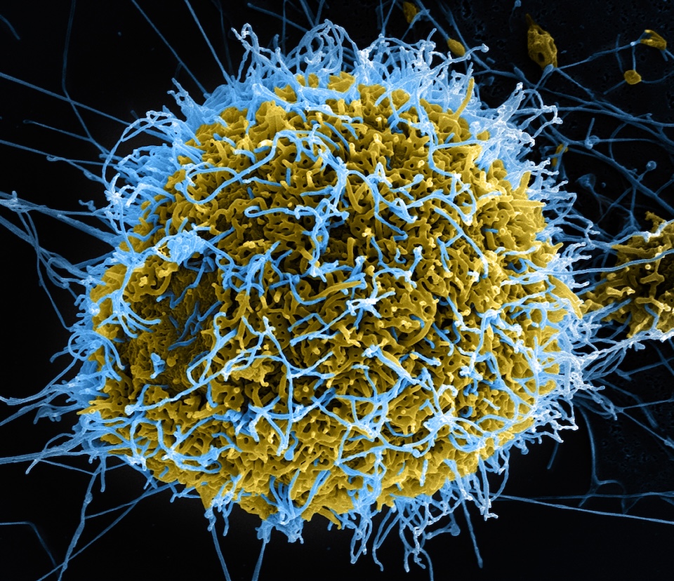 Texas Biomed testing preclinical Ebola therapies to help fast-track response as African outbreak continues Image